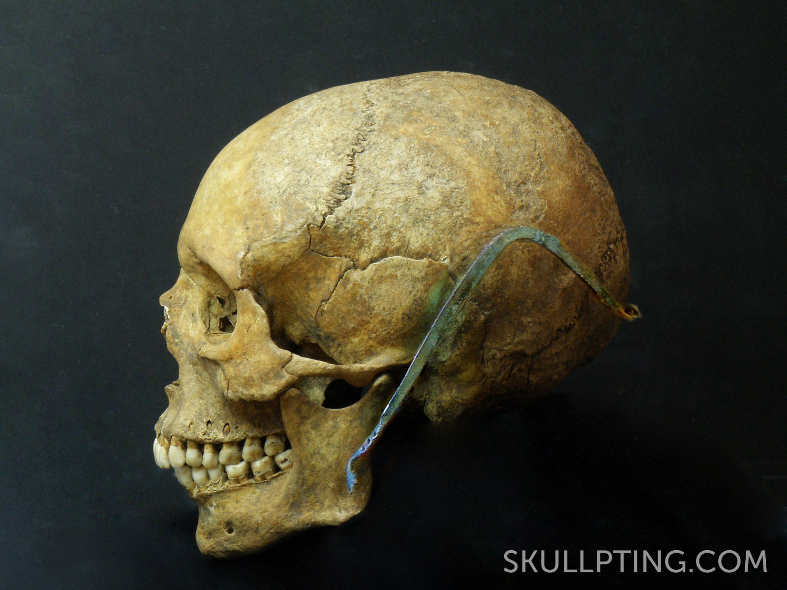 Skull with cap broach.